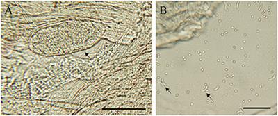 Molecular detection and identification of three intracellular parasites of retail mutton products in Beijing, China